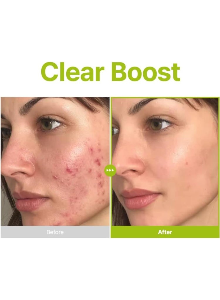PURITO SEOUL Azelaic Acid 10 Kojic Tea Tree Serum – Korean Brightening Serum for Blemishes & Uneven Skin Tone - Image 3