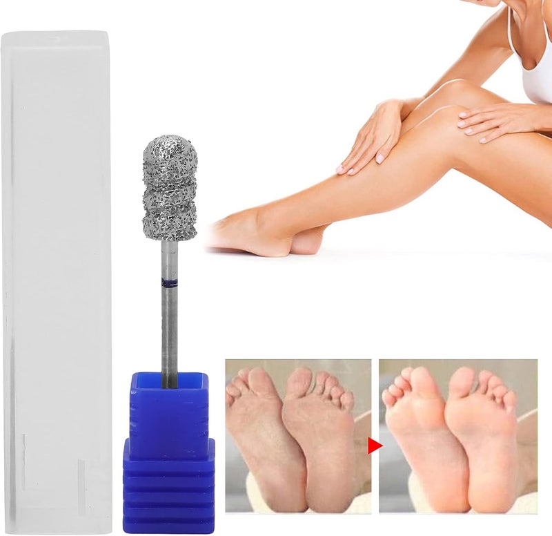 klarako Nail Bit Bits, Foot Dead Skin Removal Nail Drill Bit, Pedicure Polishing Grinding Head Replacement Parts, Professional Nail Bit Attachments Removing Gel Acrylic Cuticle For Manicure Pedicure(#2) - Image 2