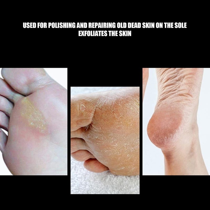 klarako Nail Bit Bits, Foot Dead Skin Removal Nail Drill Bit, Pedicure Polishing Grinding Head Replacement Parts, Professional Nail Bit Attachments Removing Gel Acrylic Cuticle For Manicure Pedicure(#2) - Image 5