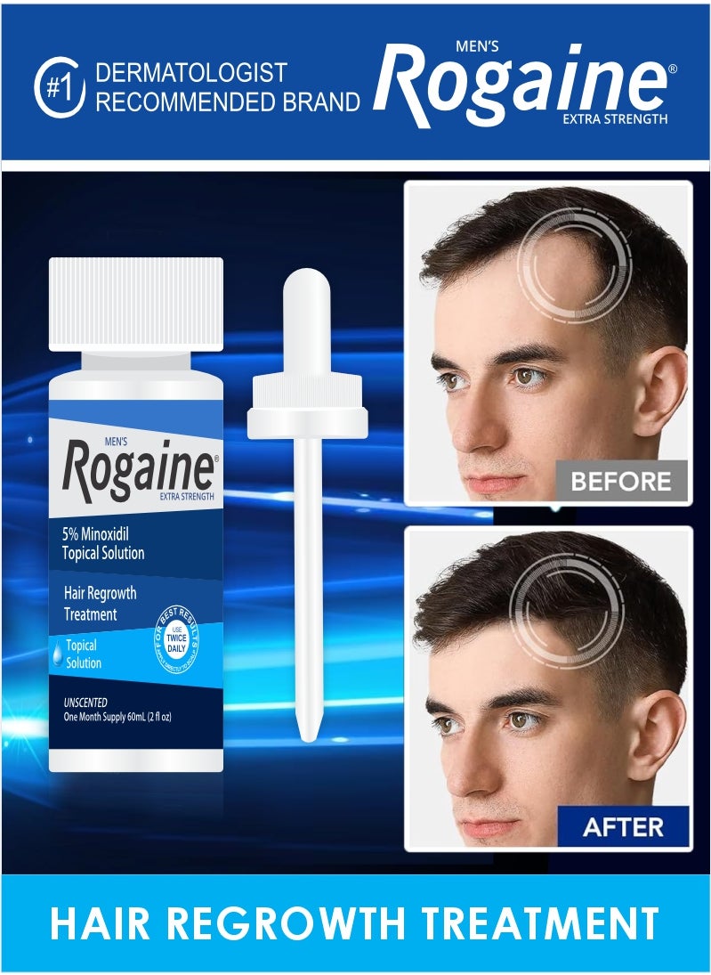 Men’s Rogaine 60 ML – Stop Hair Loss and Regrow Thicker Hair - pzsku/Z4D304531644EDC1C4E6CZ/45/_/1735032663/0b43d850-4e83-48f2-89e2-f713cb6fc413