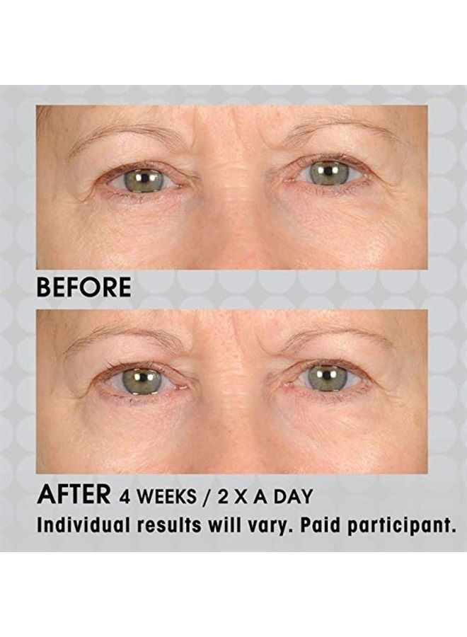 nassif md NassifMD Under Eye Smoother Firming Eye Cream, Anti Aging Eye Cream for Women, Under Eye Cream Dark Circles and Puffiness, Eye Serum Anti Aging Wrinkles - Image 5