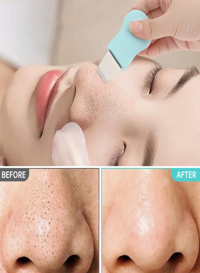 WeiLingBo Blackhead Remover Tool Set,Silicone Blackhead Scraper,Face Scraper and Pore Cleaning Brush,Skin Scrubber Face Spatula for Deep Cleansing,Face Exfoliator Scrubber for Women Men - Image 4