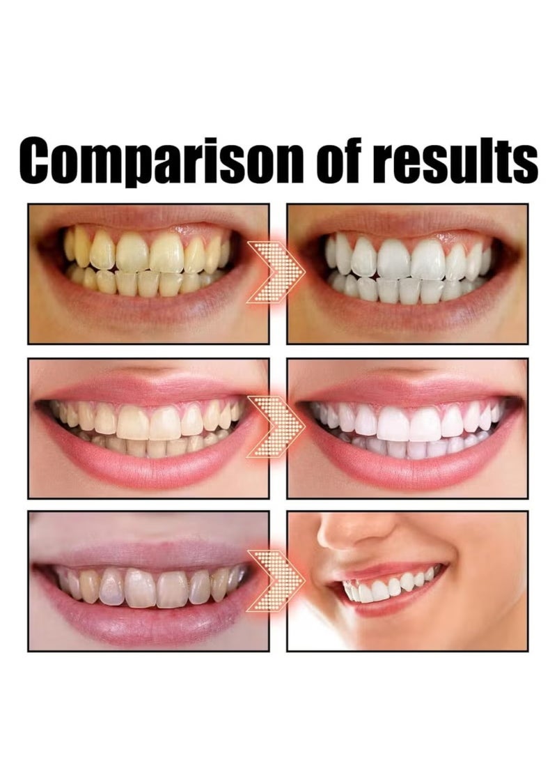 SIP-7 Super Whitening Toothpaste, SIP-7 Probiotic Whitening Toothpaste, Probiotic Whitening Toothpaste, SIP-7 Paste Oral Health Management, Fresh Breath - Image 3