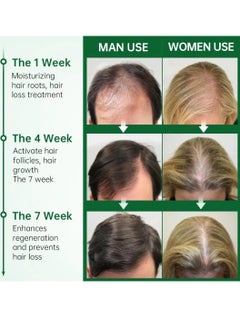 PURC 50ml Rosemary Hair growth Essential Oil Rosemary Essential Oil for Hair Growth Organic Hair growth Oil Hair Regrowth Treatment for Women and Men Hair Strengthening Rosemary Oil  - Image 3