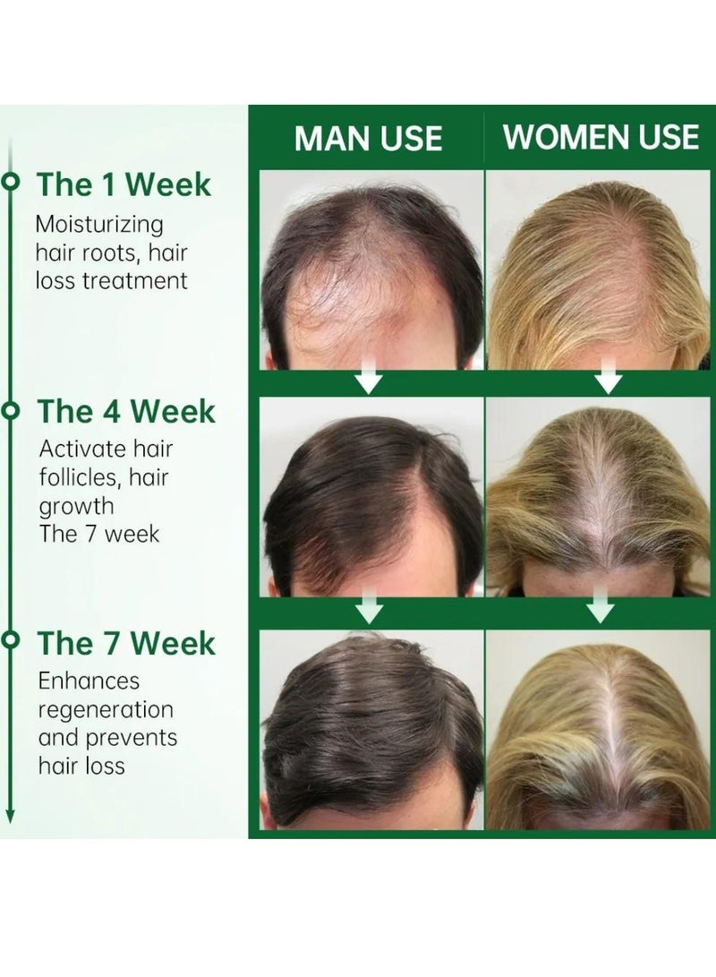 PURC 50ml Rosemary Hair growth Essential Oil Rosemary Essential Oil for Hair Growth Organic Hair growth Oil Hair Regrowth Treatment for Women and Men Hair Strengthening Rosemary Oil - Image 3