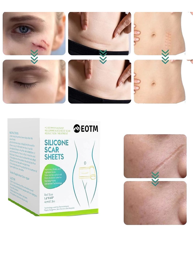 EOTM Professional Silicone Scar Sheets Scar Removal Tape For C-Section, Surgery, Burn, Keloid, Acne, Roll Size 1.6" X 60"  - Image 1