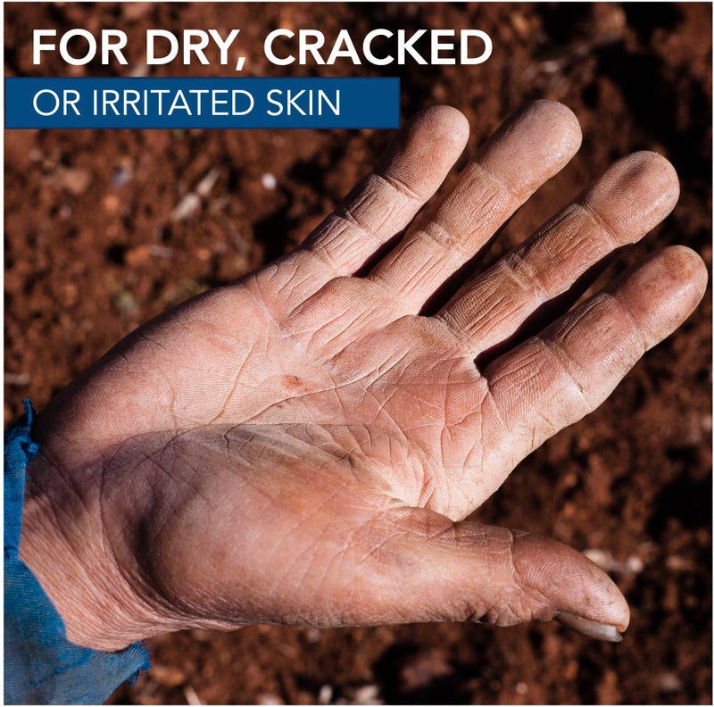 DERMATONE Camphor Ice | Balm for Dry, Cracked and Chapped Skin | Lips, Hands, Feet | Skin Repair | Sunburn | Bug Bites | Minor Burns | Soothing Vapors | Nasal Congestion, 1 oz stick - Image 3