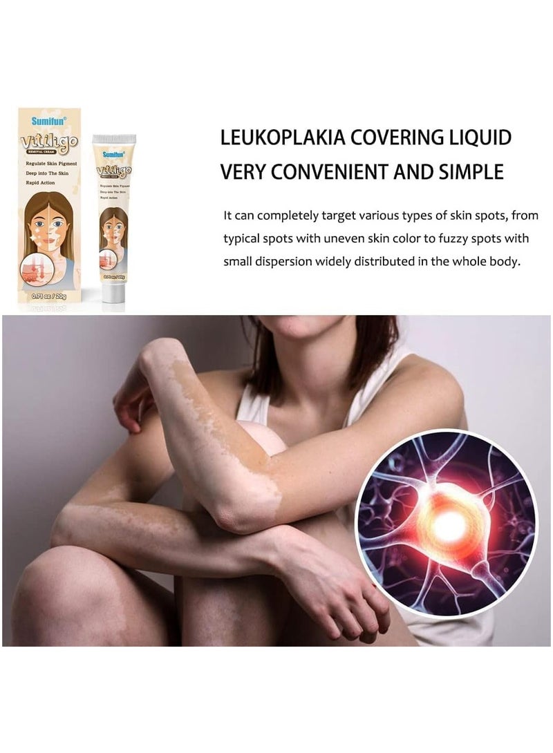 سوميفون كريم العناية بالبشرة فيتيليغو ، يقلل من البقع البيضاء ، وتحسين صبغة الجلد - Image 3