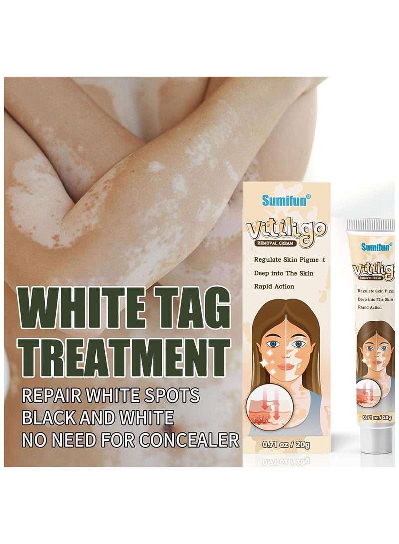 سوميفون كريم العناية بالبشرة فيتيليغو ، يقلل من البقع البيضاء ، وتحسين صبغة الجلد - Image 4