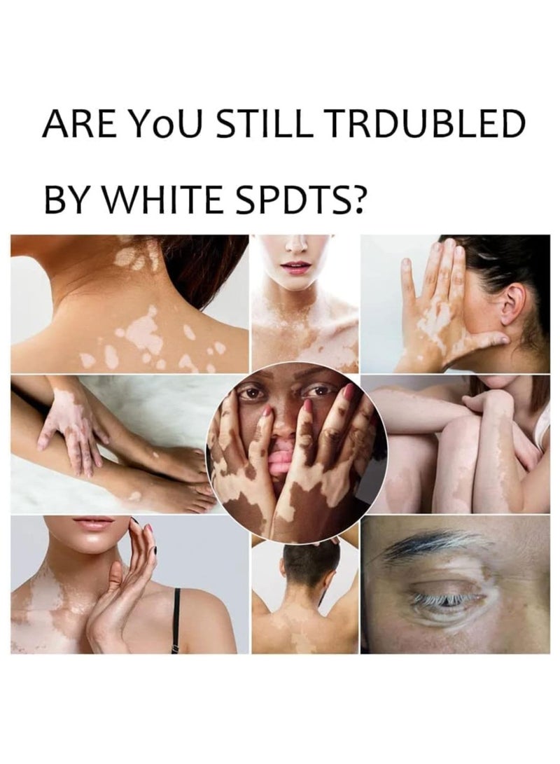 سوميفون كريم العناية بالبشرة فيتيليغو ، يقلل من البقع البيضاء ، وتحسين صبغة الجلد - Image 5