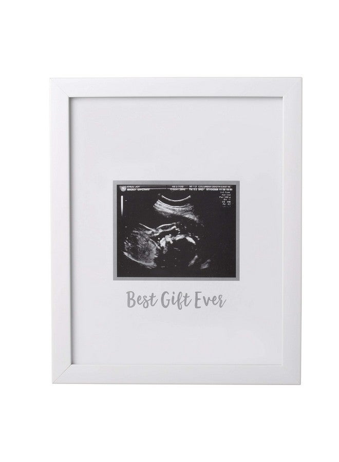 Tiny Ideas Sonogram Signature Frame Guest Book Ultrasound Picture Keepsake Gender Neutral Baby Shower Party Decor Gift For Expecting Moms Alternative Guest Book White With Included Marker - Image 3