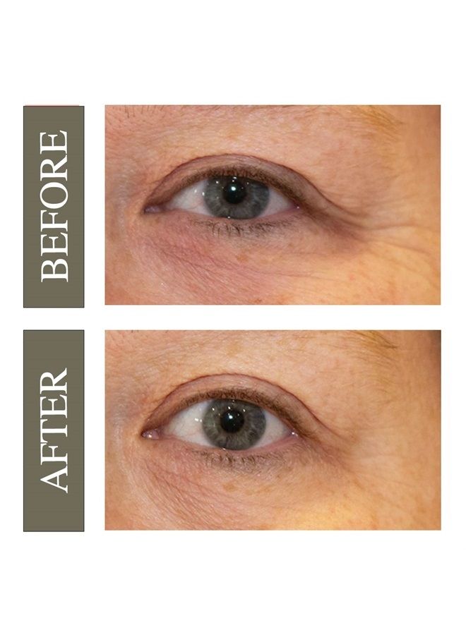 Hey Honey Open Your Eyes Lifting Eye Serum | Under Eye Cream for Dark Circles & Puffiness | Around The Eyes Hydration | Suitable For Sensitive Aging Skin | Delivers A Bright Rested look | 0.5 oz. - Image 3