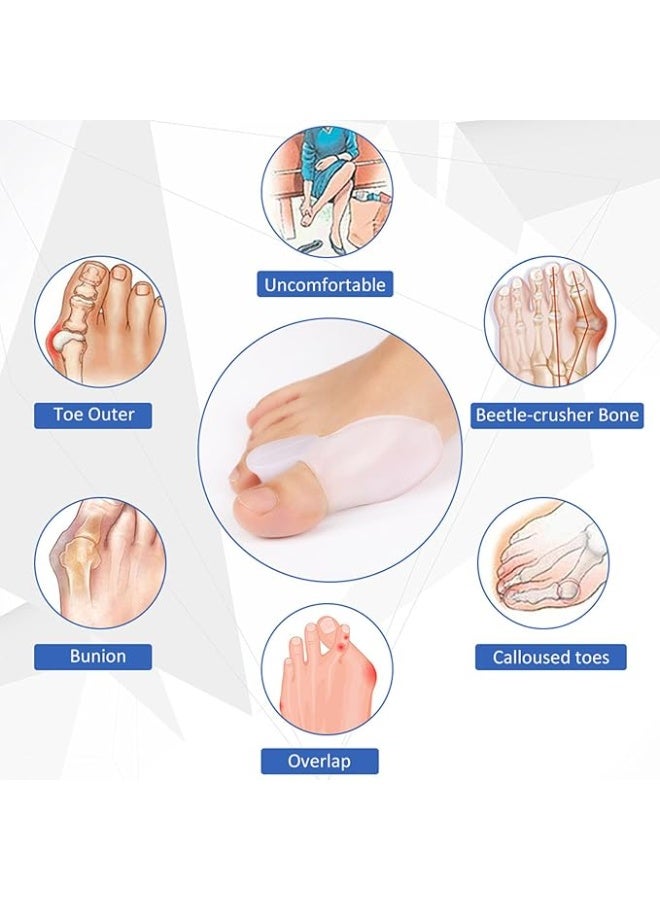 ضمادات تقويم أصابع القدم، فواصل، دعامة، 4 قطع، مصحح لأصابع القدم المطرقية، أصابع القدم المتداخلة، أصابع القدم المنحنية، أصابع القدم المخلبية، دعامة قابلة لإعادة الاستخدام لأصابع القدم المكسورة، للرجال والنساء، مقاس واحد - Image 2