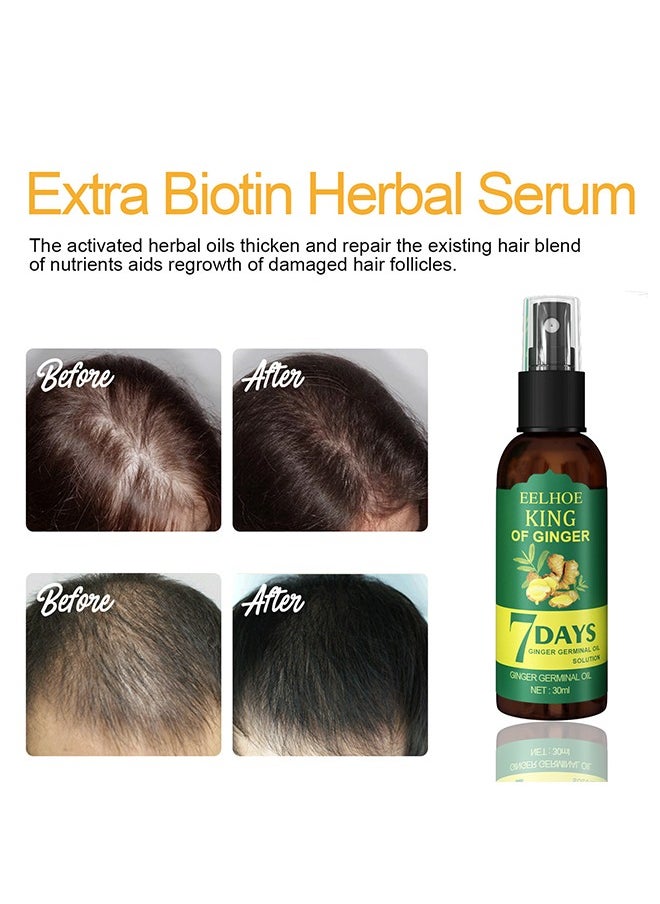 EELHOE - Ginger Hair Growth Spray, Rapid Growth Hair Treatment 7 Day Hair Growth Serum Essence Oil Regrow, Ginger Essential Oil Stop Hair Loss Hair, Thinning Treatment Hair Growth Oil For Women & Men 30ML - Image 1