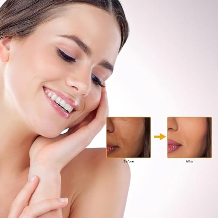 Elitzia CO₂ Facial Kit - 6 Sets/Box for CO₂ Oxygen Facial Machine, Complexion Luminating & Radiance Boost ETDGEL6 (Luminating Formula) - Image 3
