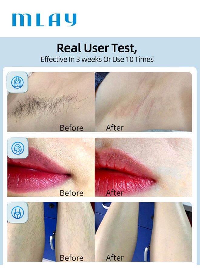 كينسي بيوتي جهاز MLAY T14 IPL محدث لإزالة الشعر غير مؤلم بالليزر مع مصباح بيكيني (مع مزيل الرؤوس السوداء هدية) 500000 نبضات 5 مستويات أزرق سماوي - Image 4