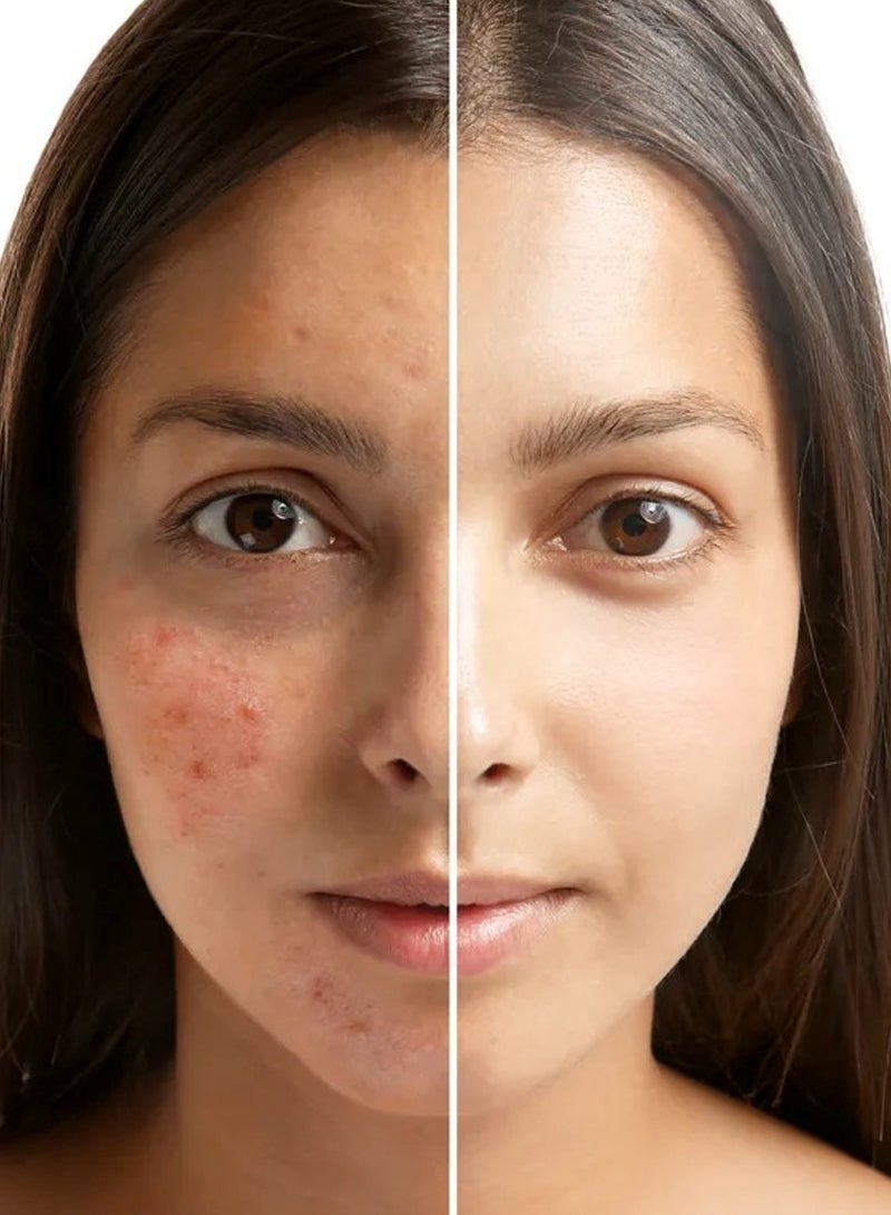 Face Fresh Set of 3 Gold Plus Beauty Soap - Improves Skin Health, Uneven Skin Tone & Appearance of Dull, Tired & Stressed Skin, Soap for All Skin Types 100g - Image 5