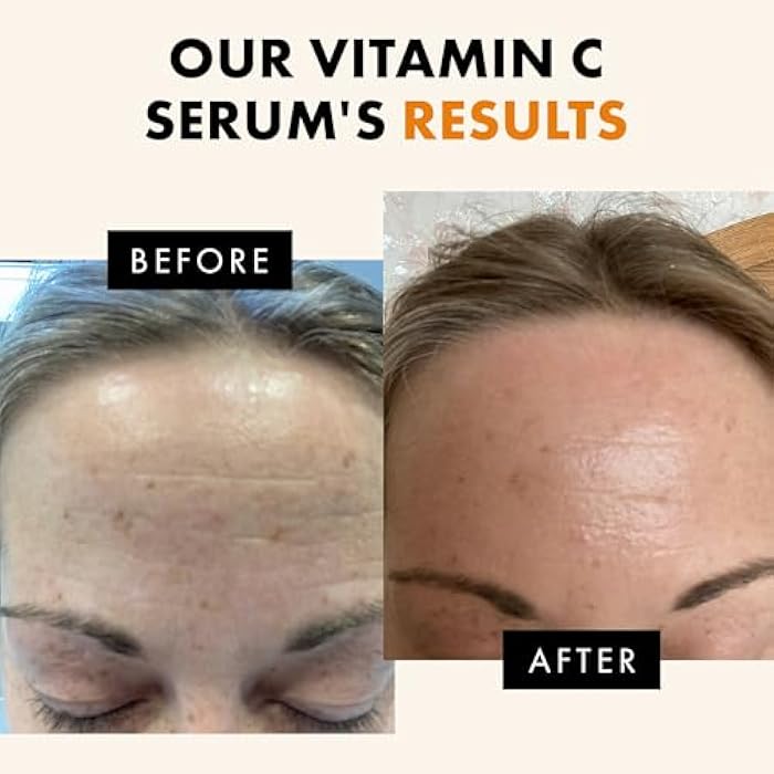 Eclat Skincare Vitamin C Face Serum - Skin Care for Dark Spots, Vitamin C Serum with Hyaluronic Acid, Ferulic Acid, Vit E - Anti Aging and Skin Brightening, Vit C Stocking Stuffers for Women 1 Fl Oz - Image 4