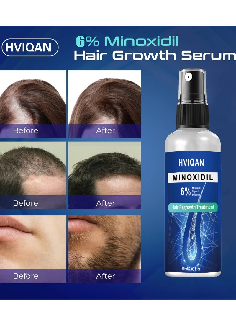 Hviqan 6% Minoxidil Hair Densifying Spray Scalp Nutrient Spray 60ml - Image 4