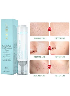 AuQuest Salicylic Acid Acne Treatment Cream - Whitening Facial Treatment Hyaluronic Acid Black Dots Remove Skin Care Beauty Health 15ml  - Image 5