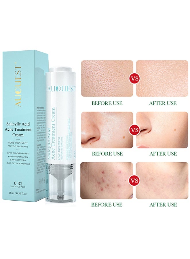 AuQuest Salicylic Acid Acne Treatment Cream - Whitening Facial Treatment Hyaluronic Acid Black Dots Remove Skin Care Beauty Health 15ml - Image 5