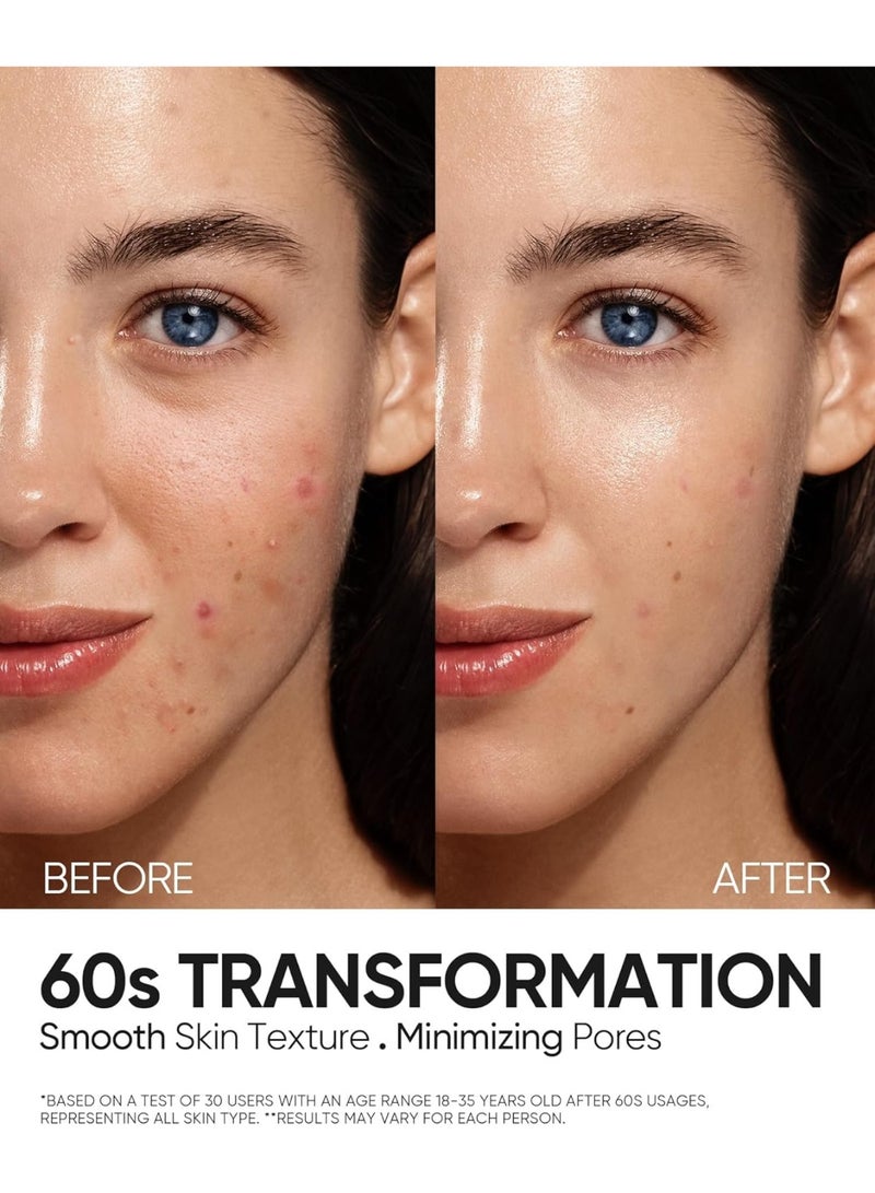 SKINTIFIC 12% AHA BHA PHA LHA Peeling Solution, Glycolic Acid Acne Treatment for Face, Exfoliating Peeling Serum for Dull, Rough, Oily Skin with Clogged Pores u0026 Dead Cells - Image 5