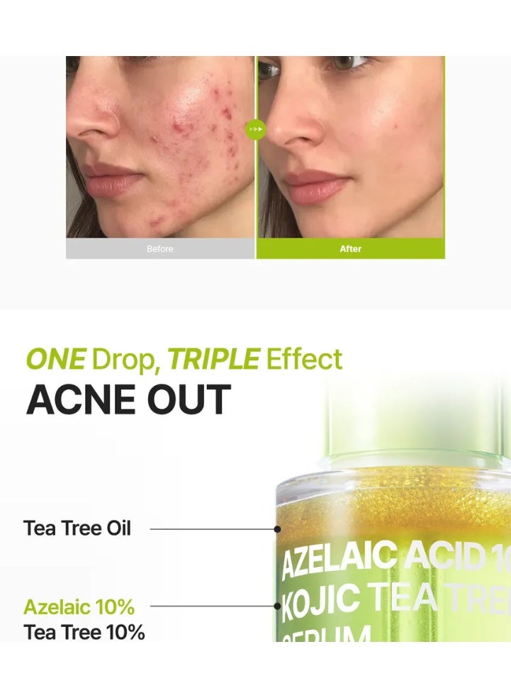 بوريتو سيروم شجرة الشاي وحمض الكوجيك والأزيليك بتركيز 10% من بيوريتو - Image 3