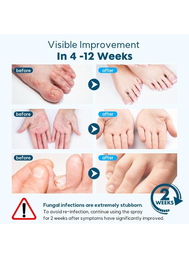 ximonth Foot Spray with Tea Tree Oil, Foot Care Dry Feet Plantar Moisturizing Deodorant, Advanced Foot and Nail Spray 100ML - Image 3