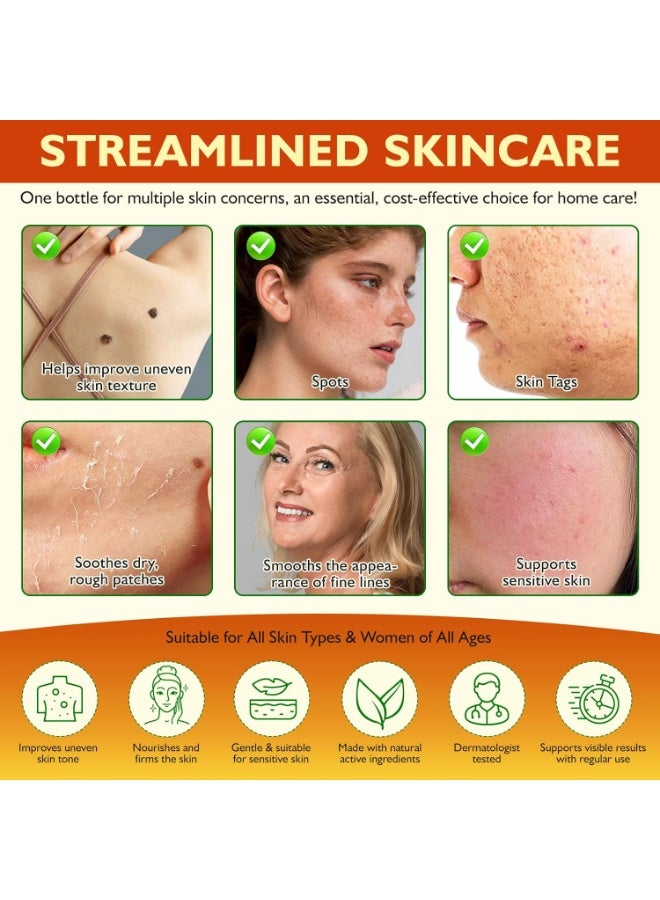 إليمي Bee Venom Cream Skin Wart&Tag Remover, Bee Venom Skin Treatment Cream for Tag and Spot Removal, تعزيز وتقوية الصيغة مع زيت شجرة الشاي, مرطب مهدئ وإصلاح لجميع أنواع البشرة - Image 5