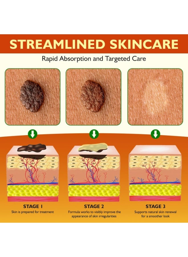 إليمي Bee Venom Cream Skin Wart&Tag Remover, Bee Venom Skin Treatment Cream for Tag and Spot Removal, تعزيز وتقوية الصيغة مع زيت شجرة الشاي, مرطب مهدئ وإصلاح لجميع أنواع البشرة - Image 4