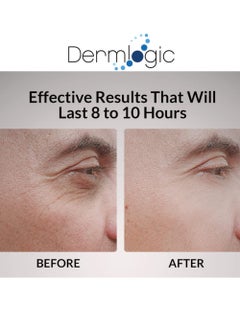Dermlogic Under Eye Puffiness & Dark Circles Rapid Treatment- Instantly Reduces the Appearance of Puffy Eye Bags, Crow’s Feet, & Sagging Skin.  - Image 4