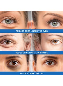 Dermlogic Under Eye Puffiness & Dark Circles Rapid Treatment- Instantly Reduces the Appearance of Puffy Eye Bags, Crow’s Feet, & Sagging Skin.  - Image 3
