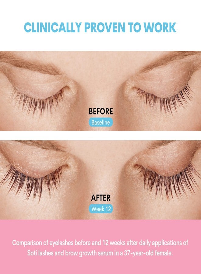 سوتي زيت الخروع العضوي من سوتي، معتمد من وزارة الزراعة الأمريكية، نقي 100%، معصور على البارد، خالٍ من الهكسان (2 أونصة)، سيروم للرموش والحواجب، لنمو الرموش، للشعر، مرطب للبشرة، نباتي، غير مخفف، زجاجة (2 أونصة) - Image 2