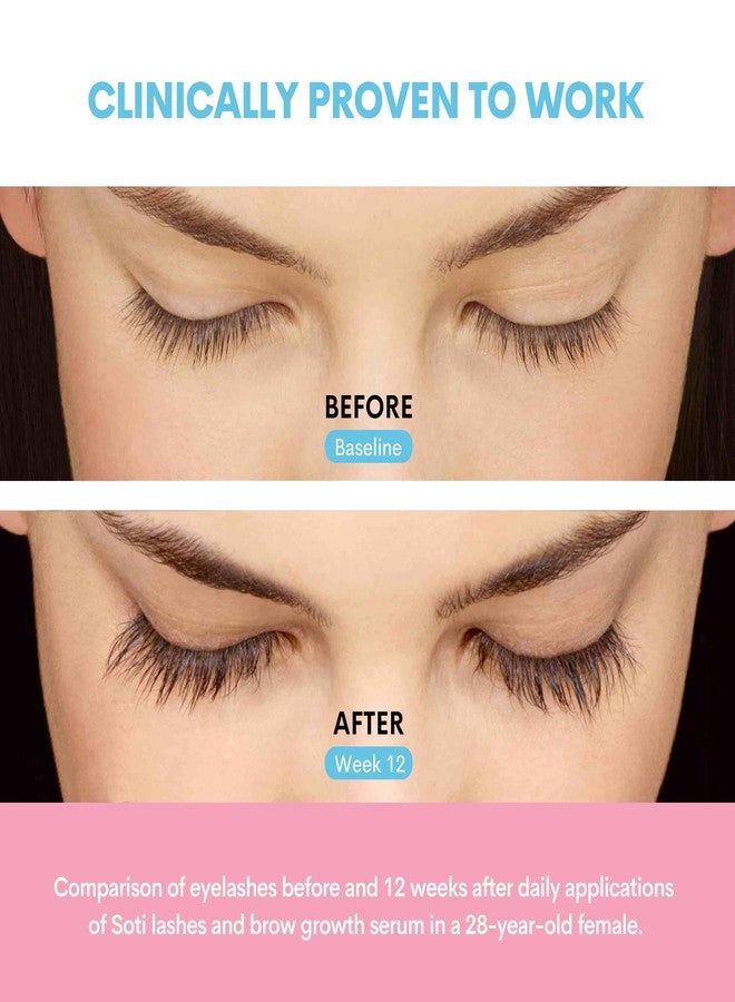 سوتي زيت الخروع العضوي من سوتي، معتمد من وزارة الزراعة الأمريكية، نقي 100%، معصور على البارد، خالٍ من الهكسان (2 أونصة)، سيروم للرموش والحواجب، لنمو الرموش، للشعر، مرطب للبشرة، نباتي، غير مخفف، زجاجة (2 أونصة) - Image 3