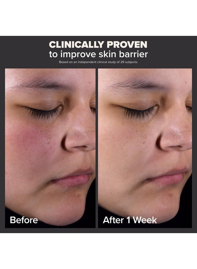 باولاز تشويس Paulas Choice--مقشر سائل بحمض الساليسيليك بنسبة 2% من Skin Perfecting--مقشر للوجه للتخلص من الرؤوس السوداء والمسام الواسعة والتجاعيد والخطوط الدقيقة، زجاجة سعة 4 أونصات - Image 2