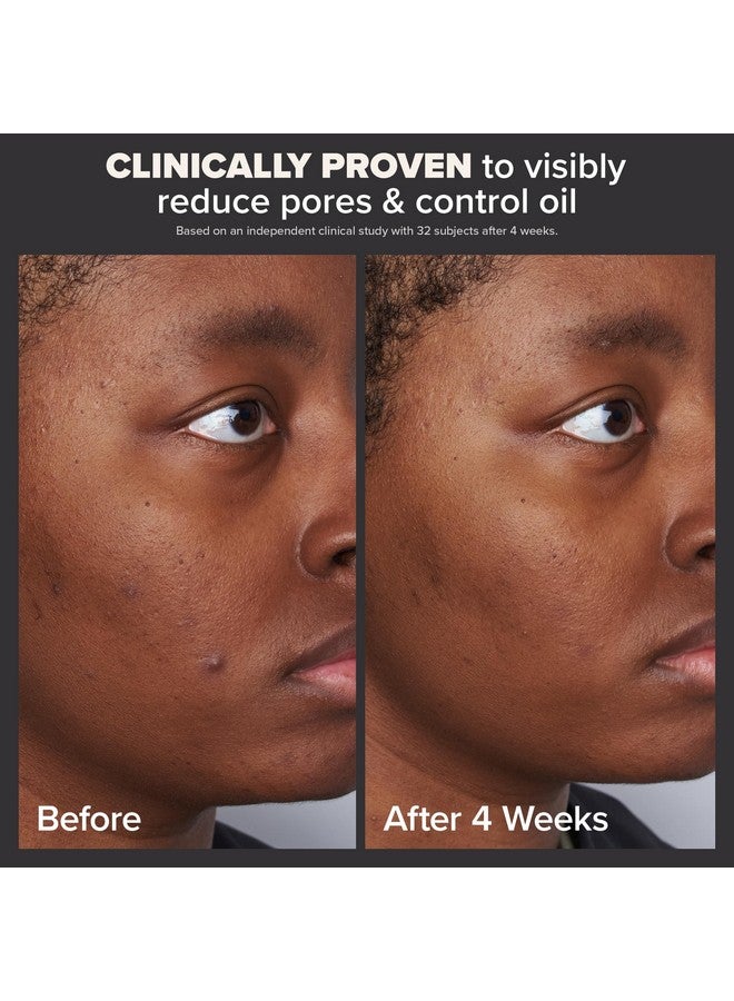 باولاز تشويس Paulas Choice--مقشر سائل بحمض الساليسيليك بنسبة 2% من Skin Perfecting--مقشر للوجه للتخلص من الرؤوس السوداء والمسام الواسعة والتجاعيد والخطوط الدقيقة، زجاجة سعة 4 أونصات - Image 3