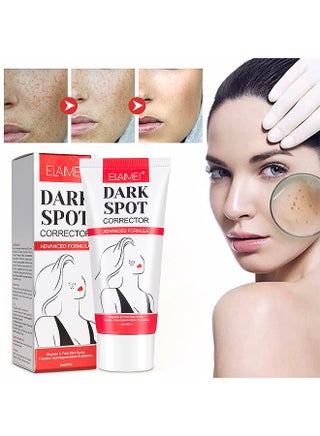 Dark Spot Corrector For Face And Body, Dark Spot Corrector Cream, Dark Spot Cream For Underarm Natural Dark Spot Correcting Cream Freckle Cream For Sun Spot, Age Spot Even Skin Tone Women Men 60G - pzsku/Z4DA9923F912E4C856093Z/45/_/1700617948/814238cc-02f1-4ed4-8d18-d78734eee966