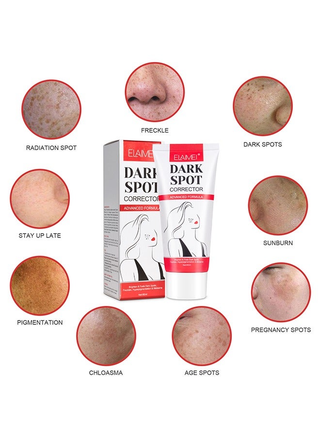 Dark Spot Corrector For Face And Body, Dark Spot Corrector Cream, Dark Spot Cream For Underarm Natural Dark Spot Correcting Cream Freckle Cream For Sun Spot, Age Spot Even Skin Tone Women Men 60G
