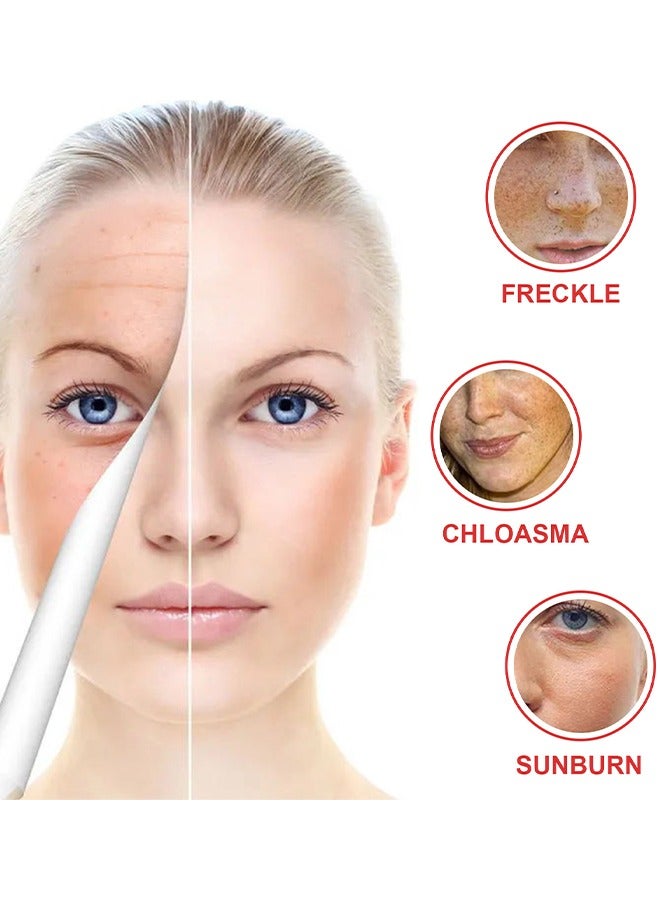 Dark Spot Corrector For Face And Body, Dark Spot Corrector Cream, Dark Spot Cream For Underarm Natural Dark Spot Correcting Cream Freckle Cream For Sun Spot, Age Spot Even Skin Tone Women Men 60G