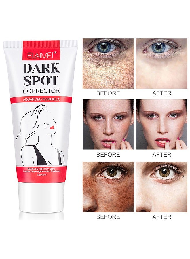 Dark Spot Corrector For Face And Body, Dark Spot Corrector Cream, Dark Spot Cream For Underarm Natural Dark Spot Correcting Cream Freckle Cream For Sun Spot, Age Spot Even Skin Tone Women Men 60G