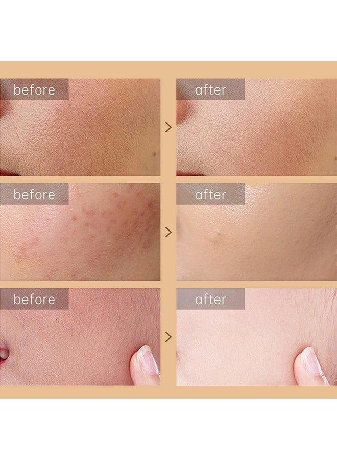 Rosarden Snail Repair Cream Snail Moisturizer With Snail Secretion Filtrate Repair Damage Skin Ruduce Fine Line Hydration Snail Face Cream For Dry Skin Snail Mucin Essence For Women Skin Care - Image 5