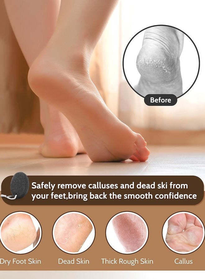 MoHern Pumice Stone Foot File, 3pcs Set Callus Remover for Feet with Wooden Handle, Pedicure Foot Scrubber to Remove Dead Skin, Dry, Rough, Corns Skin Scraper - Image 5
