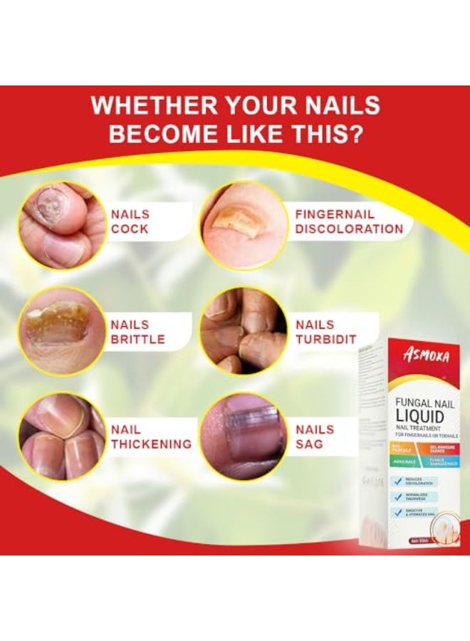ASMOXA Fungal Nail Treatment Liquid 30ml, Nail Fungus Treatment Serum for Toenails & Fingernails, Fungal Nail Renewal Anti Fungus Nail Repair Gel, Smooth & Hydrates Nail Reduce Discoloration - Image 4