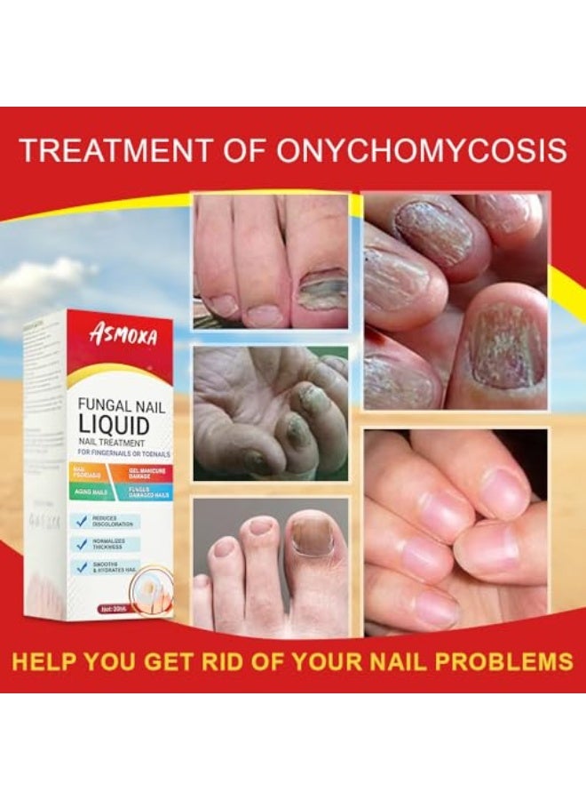 ASMOXA Fungal Nail Treatment Liquid 30ml, Nail Fungus Treatment Serum for Toenails & Fingernails, Fungal Nail Renewal Anti Fungus Nail Repair Gel, Smooth & Hydrates Nail Reduce Discoloration - Image 3