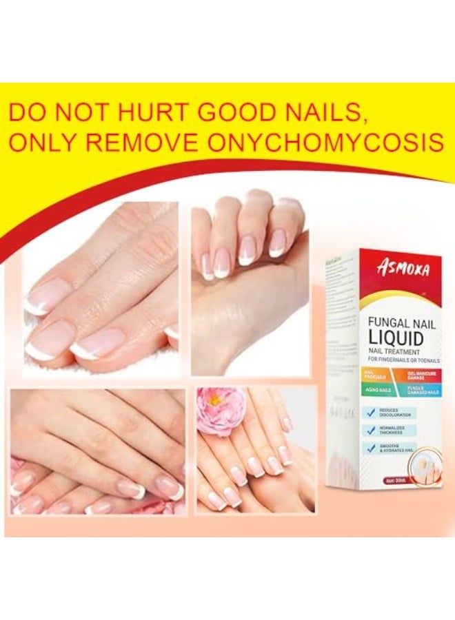 ASMOXA Fungal Nail Treatment Liquid 30ml, Nail Fungus Treatment Serum for Toenails & Fingernails, Fungal Nail Renewal Anti Fungus Nail Repair Gel, Smooth & Hydrates Nail Reduce Discoloration - Image 5
