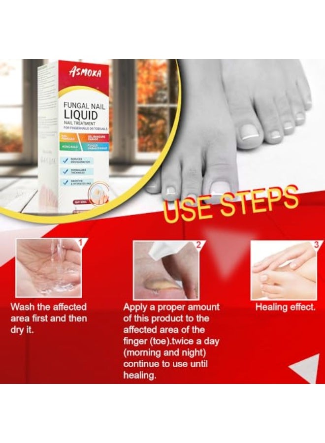 ASMOXA Fungal Nail Treatment Liquid 30ml, Nail Fungus Treatment Serum for Toenails & Fingernails, Fungal Nail Renewal Anti Fungus Nail Repair Gel, Smooth & Hydrates Nail Reduce Discoloration - Image 2