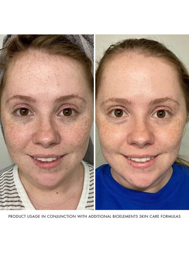 Bioelements Quick Refiner For Eyes 15ml/0.5oz - Image 5