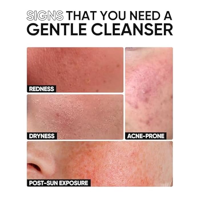 SKINTIFIC منظف وجه منخفض الحموضة 5X سيراميد، غسول وجه مرطب لطيف مع حمض الهيالورونيك، غسول يومي للوجه للبشرة الجافة إلى العادية، مختبر للبشرة الحساسة، لا يسبب الشد، خالي من العطور - Image 3