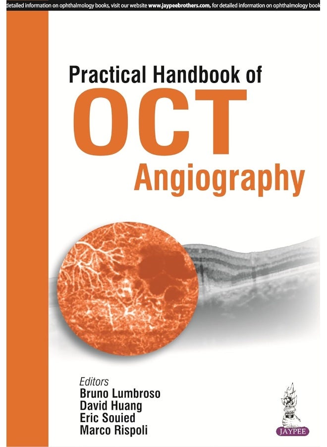 Practical Handbook of OCT Angiography