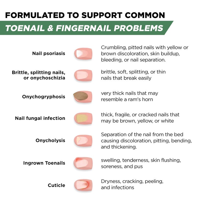 Foot Cure Toenail Renewal Solution Extra Strength Care for Toe Nail & Fingernails - Nail Repair Solution for broken, Discolored Nails - Renews Damaged Cracked Ingrown Toenail Made In USA 0.50 Fl Oz - 2 Pack - Image 4